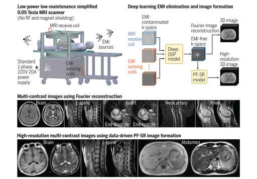 Machine learning to enable cheaper and safer low-power MRI scanners